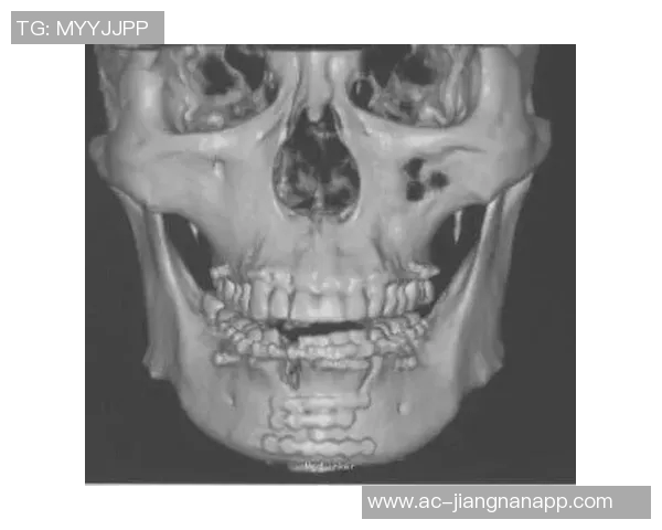 奇克遭遇重伤牙齿断裂与牙槽骨骨折预计缺阵数月
